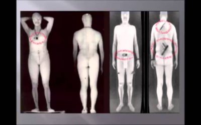 SOTG 711 – Hotels to XRAY Guests & 24 Hour Blackout